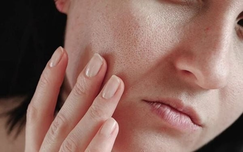 Người có làn da khô hoặc da hỗn hợp thiếu ẩm da kho thieu am