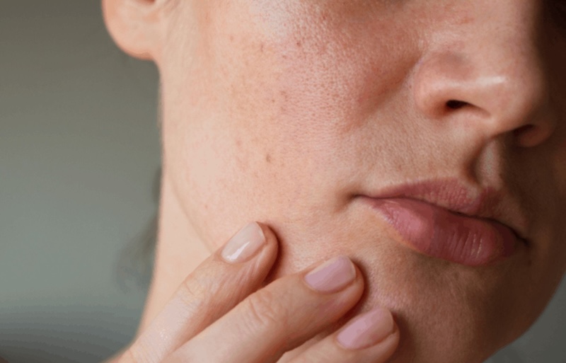 da khô da kho thieu am