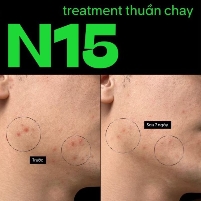 tinh chất bí đao n15 cocoon tinh chat bi dao n15 cocoon