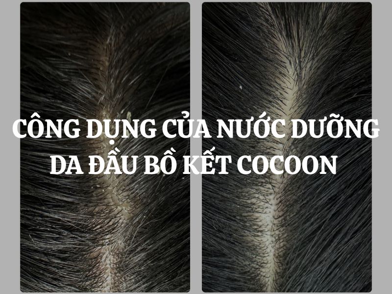 Công dụng của Nước dưỡng da đầu chiết xuất bồ kết Cocoon