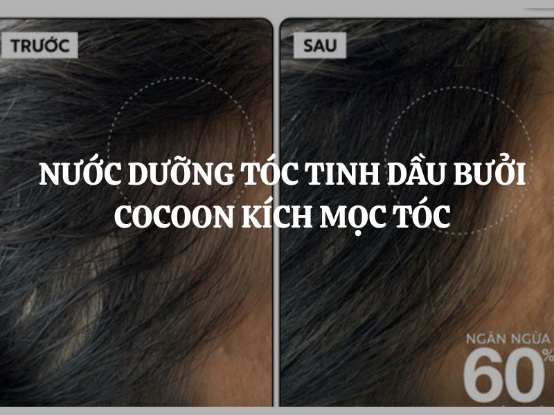 Nước dưỡng tóc tinh dầu bưởi Cocoon kích mọc tóc, giảm gãy rụng qua cơ chế nào?