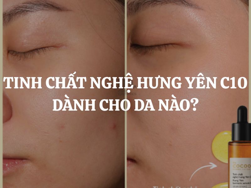 Tinh chất nghệ Hưng Yên C10 dành cho da nào? Giải đáp chi tiết